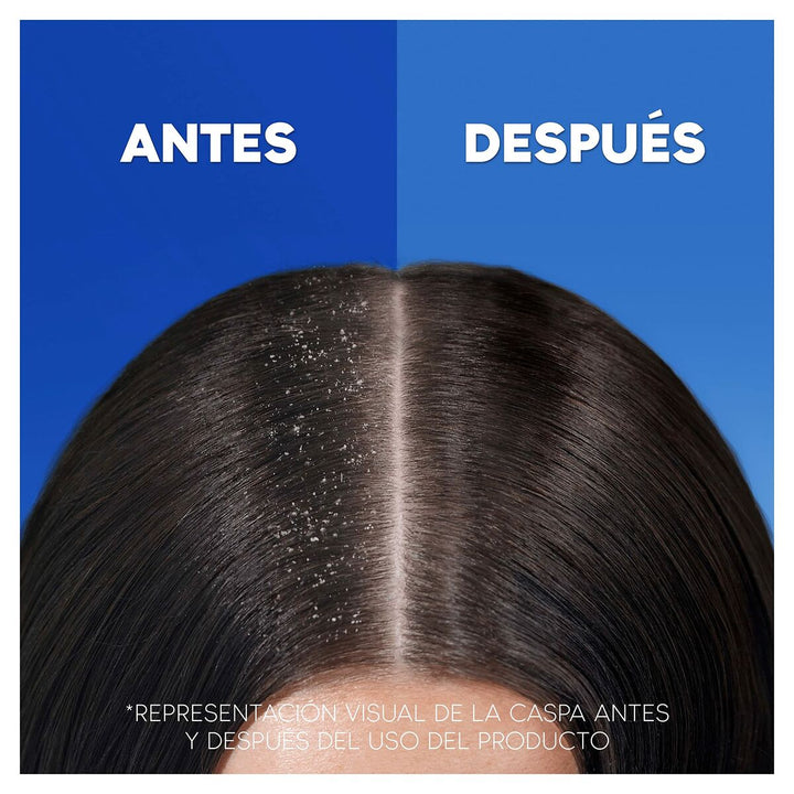 Schampo Head & Shoulders S Anticaída 1 L